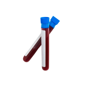 FOC H.pylori worth RM105