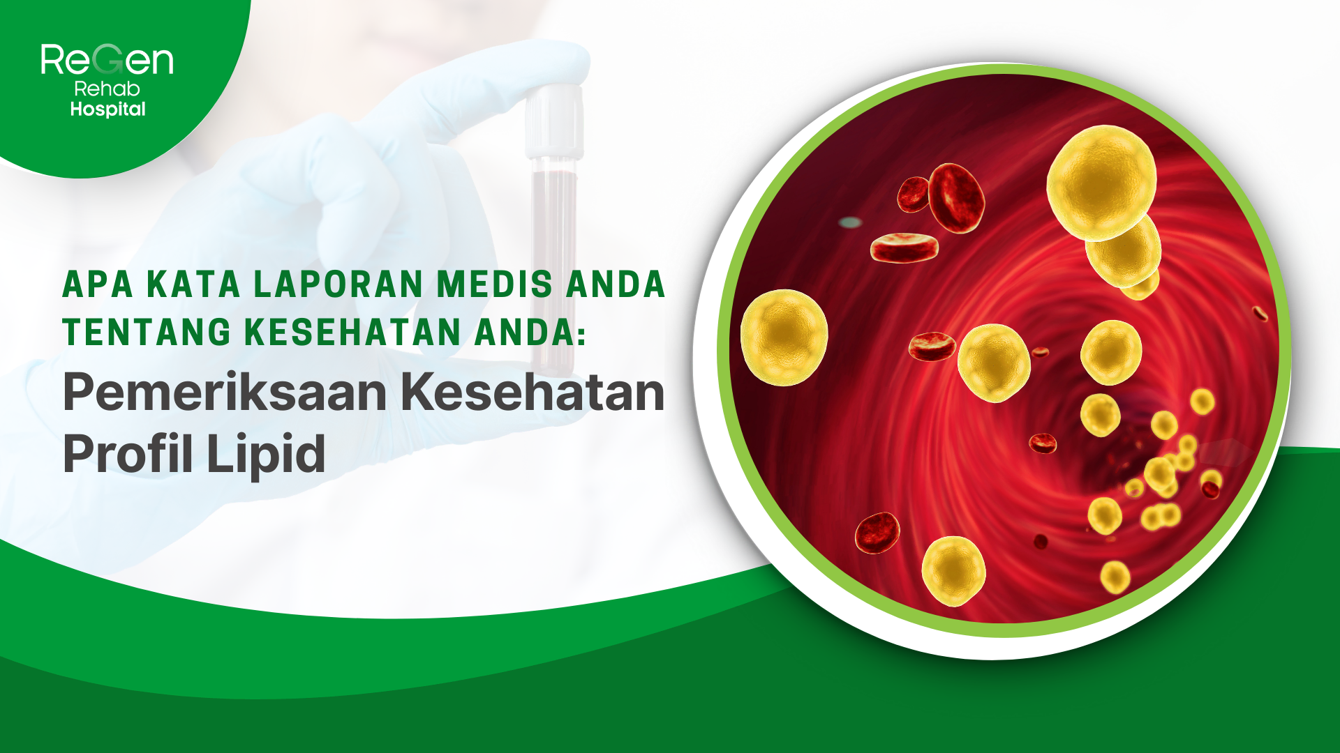 Pemeriksaan Kesehatan Profil Lipid