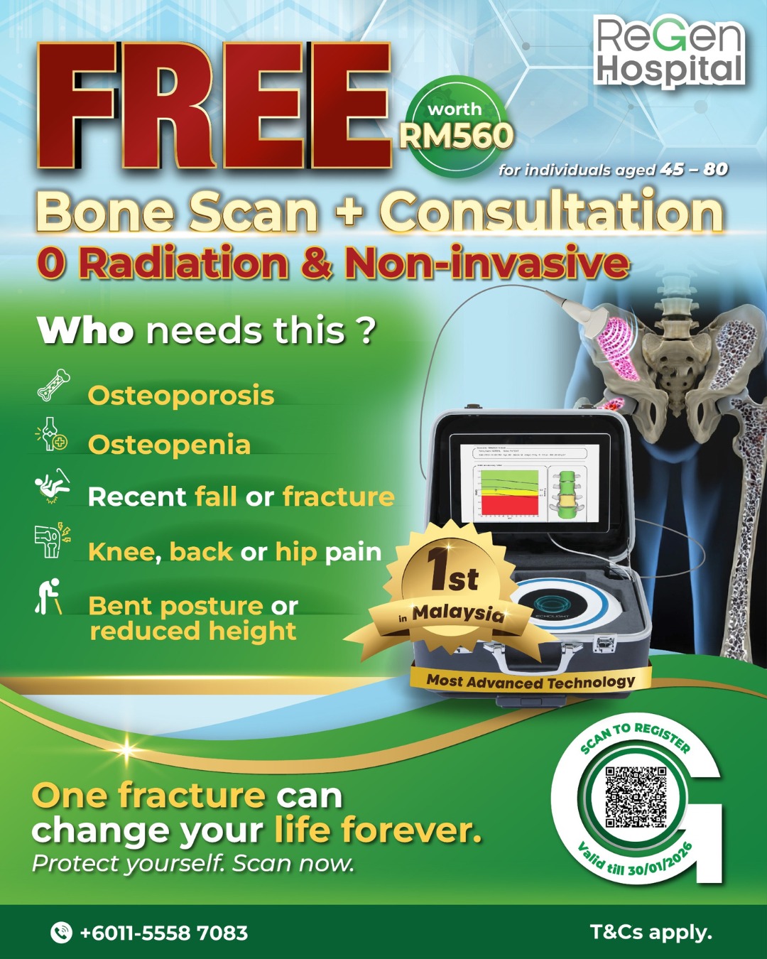 free bone scan new poster