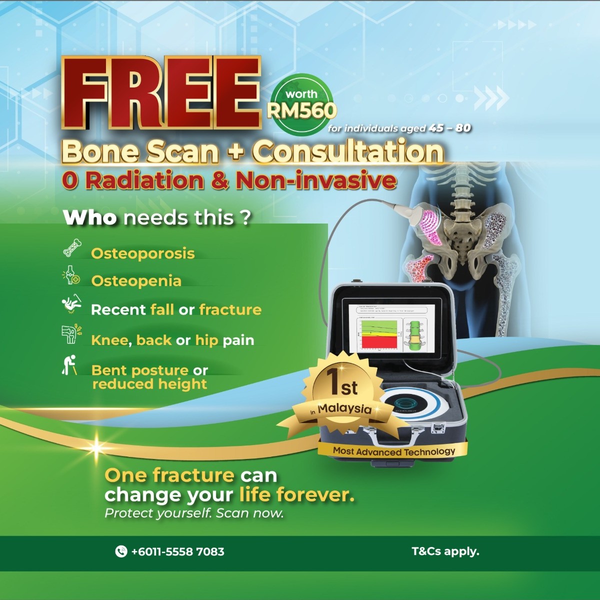 免费骨密度扫描（REMS）：及早守护骨骼健康