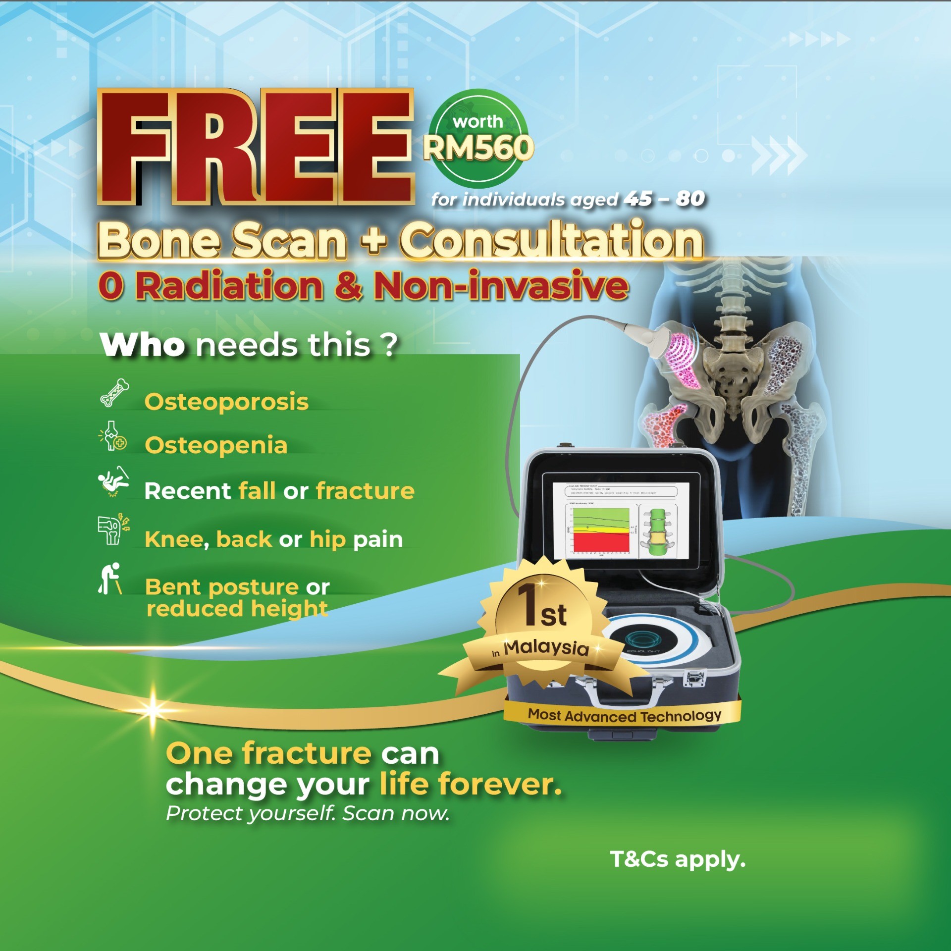 Pemindaian Tulang Gratis (REMS): Deteksi Dini untuk Kesehatan Tulang