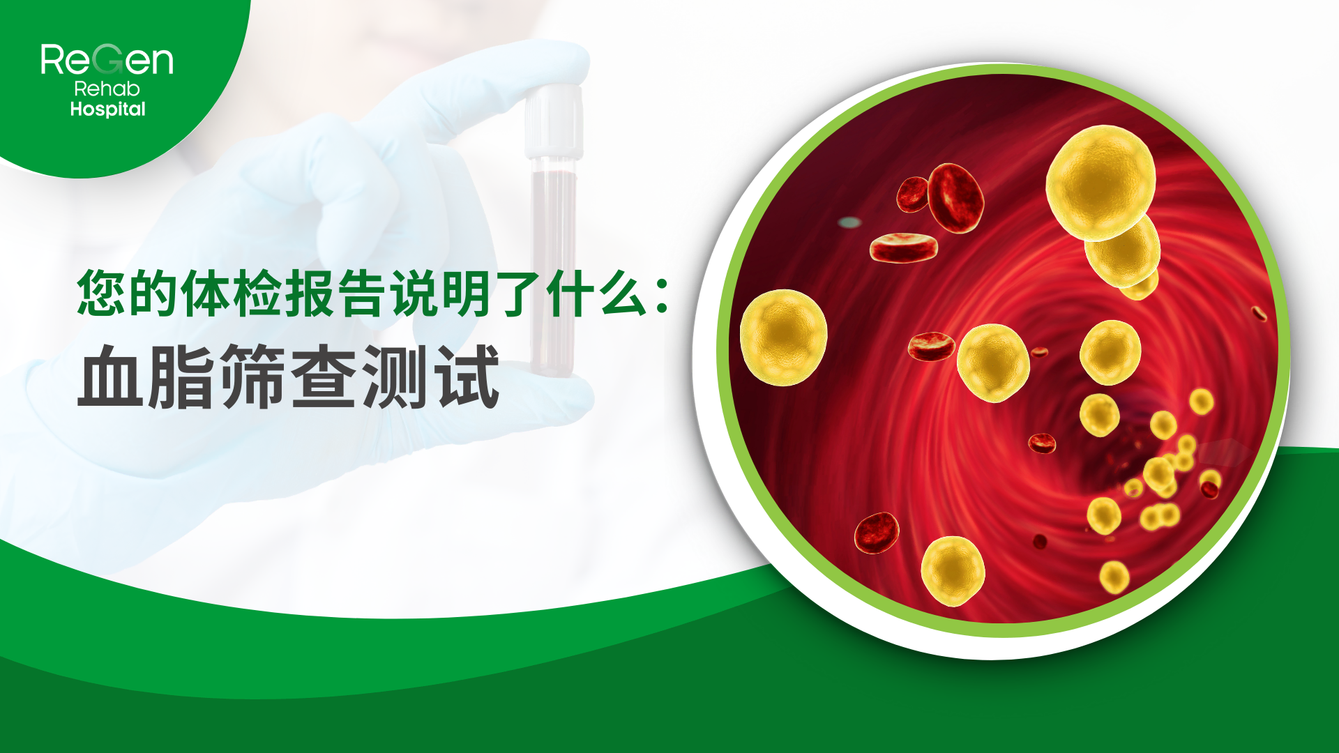 血脂筛查测试