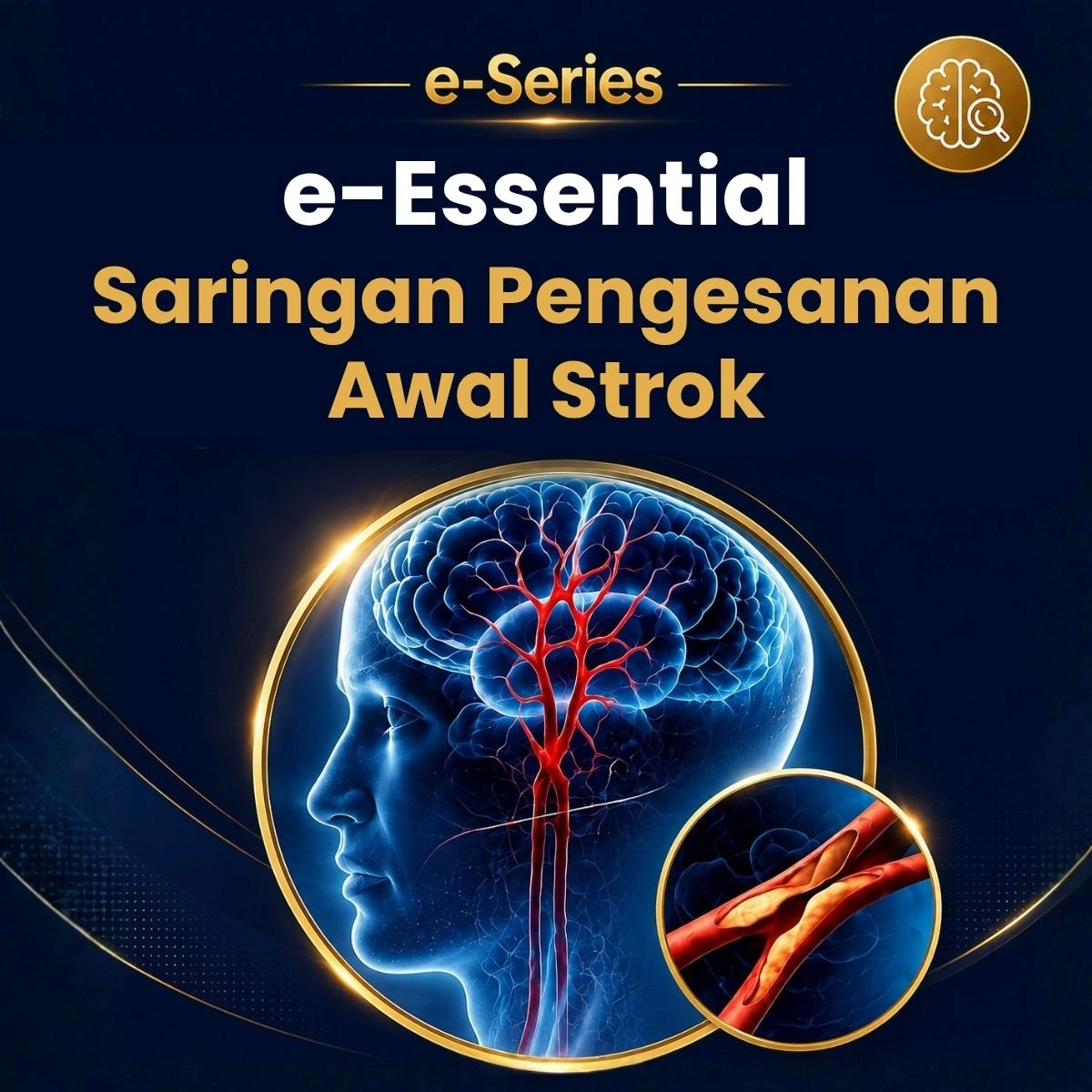 e Essential Stroke Screening